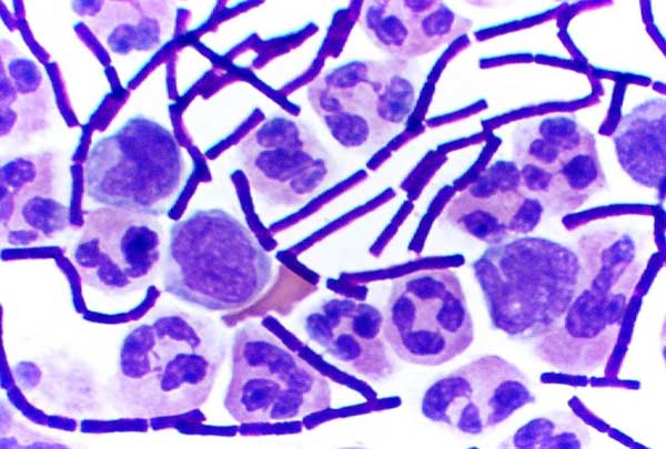DESCUBRIO EL BACILO DE LA TUBERCULOSIS descubrio el bacilo de la tuberculosis:
