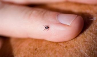 Lyme 5
