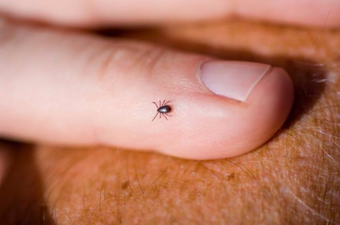 Lyme
