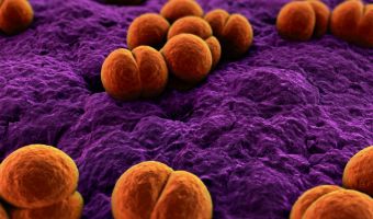 Meningitis 2