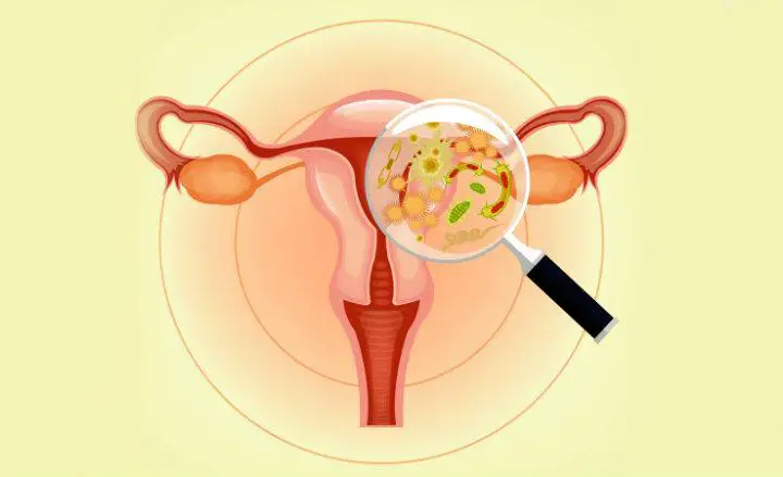 vaginitis a prostatitis miatt a prosztata korai életkorban okozza
