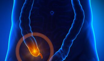 Apendicitis 1