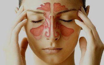 sistema-respiratorio - Sinusitis