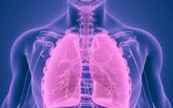 Hantavirus - Complicaciones pulmonares por hantavirus