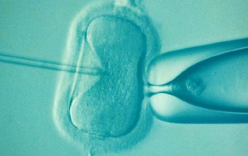 Fecundación - Fecundación in vitro