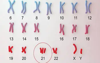 Foto de  los ganes del cromosoma 21 resaltando con un circulo su copia extra en colores rojo, rosado y azul