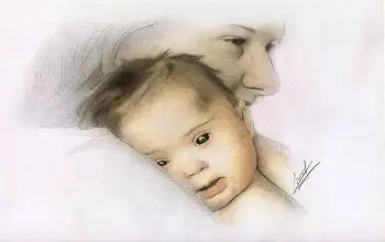 Pintura de bebe con síndrome de down abrazado con su madre en un fondo de color blanco
